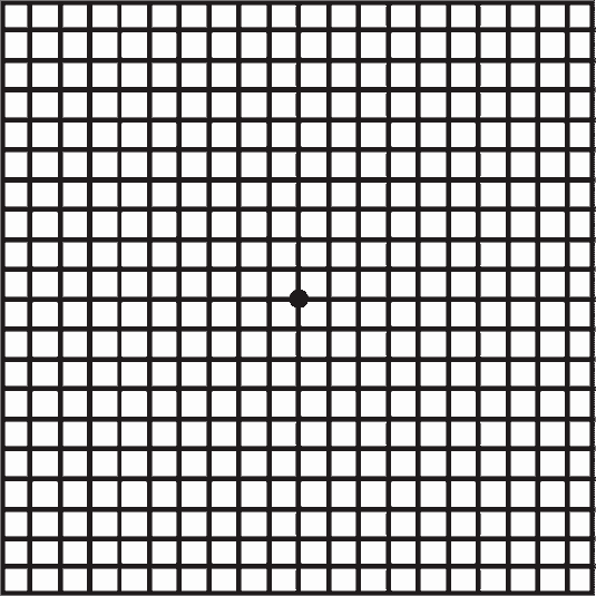 Amsler Grid